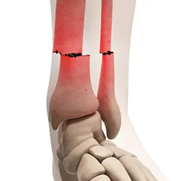 Trauma and Accident Surgery
